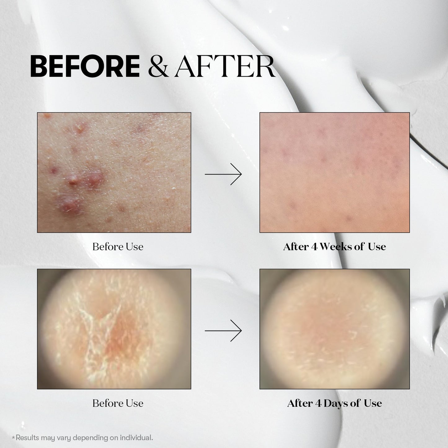 VT Cosmetics Reedle Shot 100 | Wholesale K-Beauty