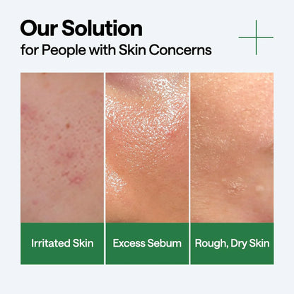 Mediheal Teatree Calming Hydra Serum | Wholesale K-Beauty