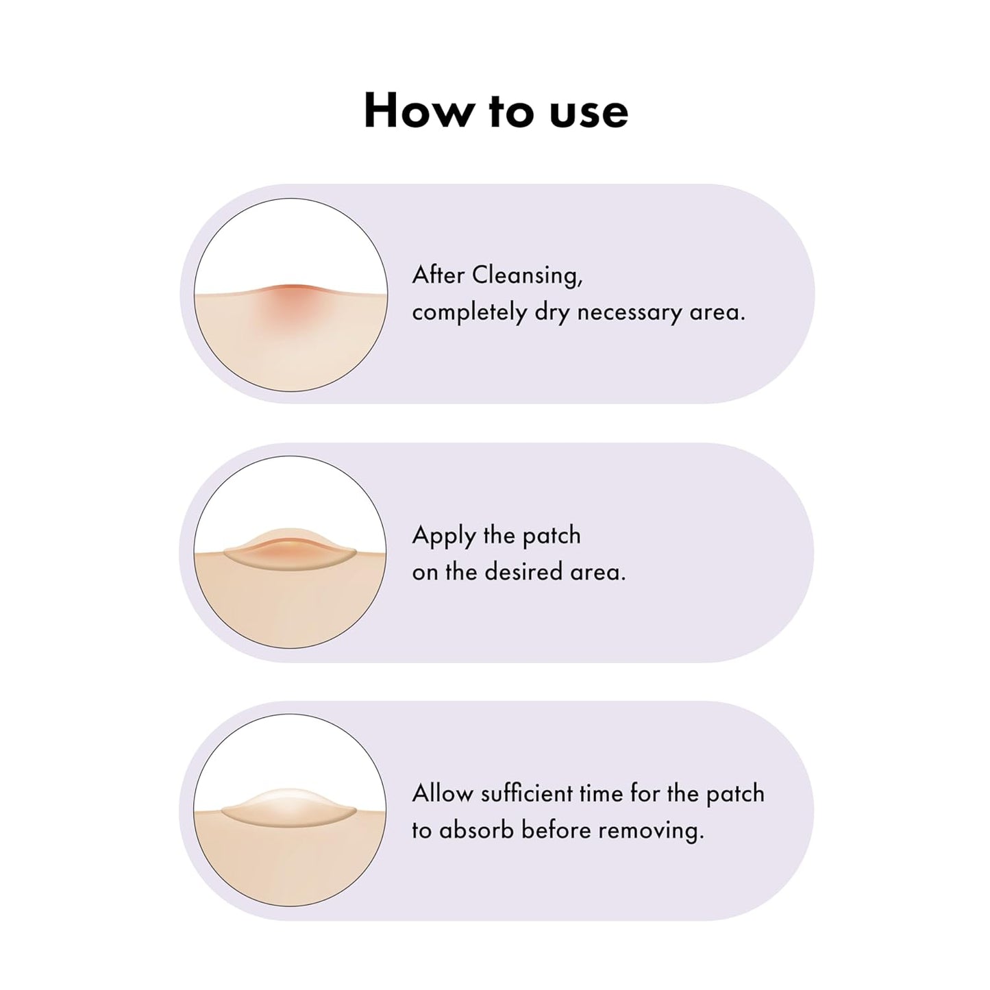 TGI PATCH Blemish Cover Cocktail (Variety Pack) - Hydrocolloid Patches for Mid-Stage of Skin Trouble (36pc), Day and Night patches plus XL size | Wholsale K-Beauty