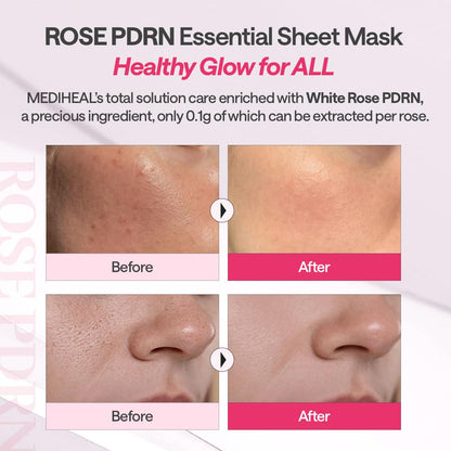 Mediheal Rose Pdrn Essential Mask (Pack of 4) | Wholesale K-Beauty