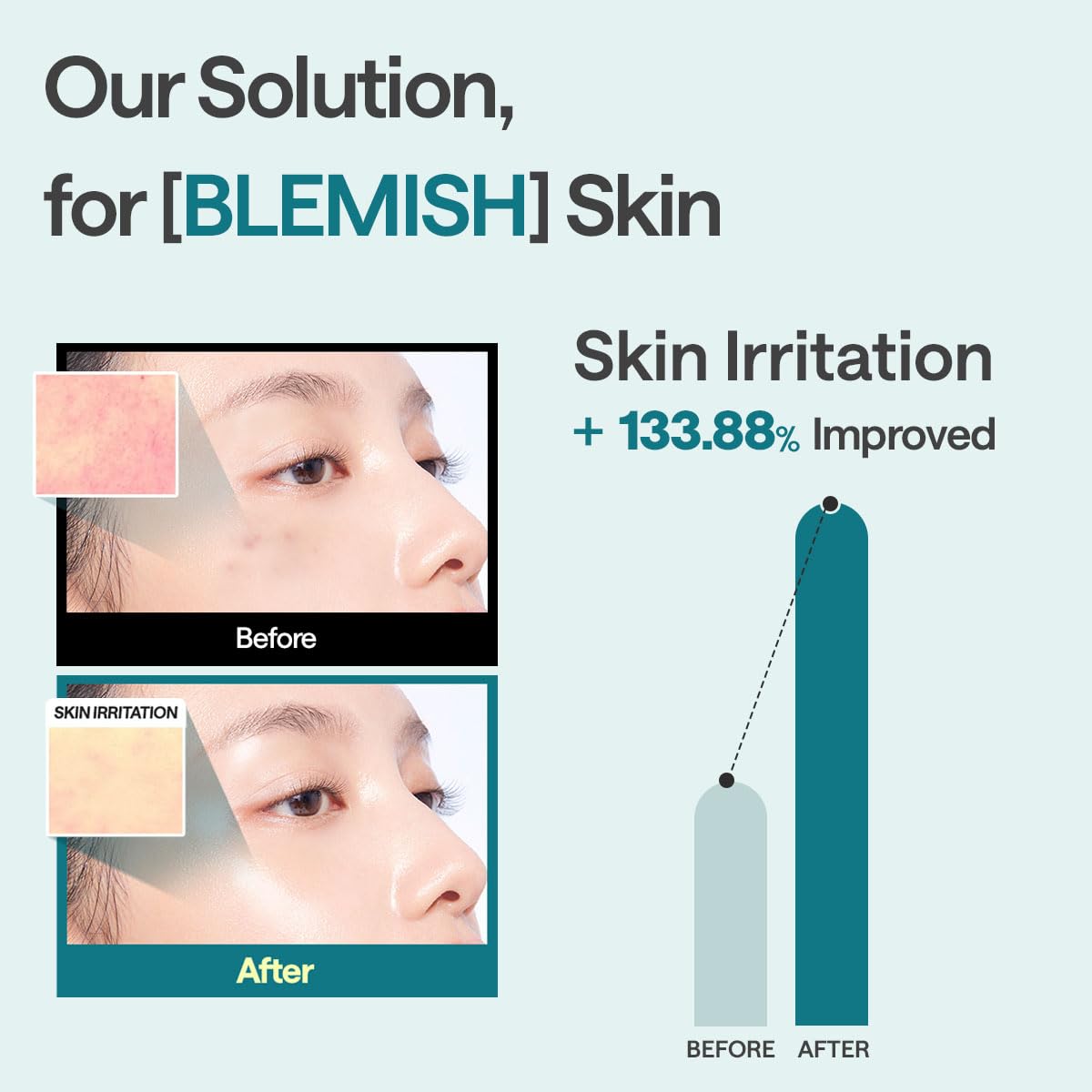 Mediheal Madecassoside Blemish Repair Mask – 98% Cica + Hydration + Soothing – Wholesale K-Beauty