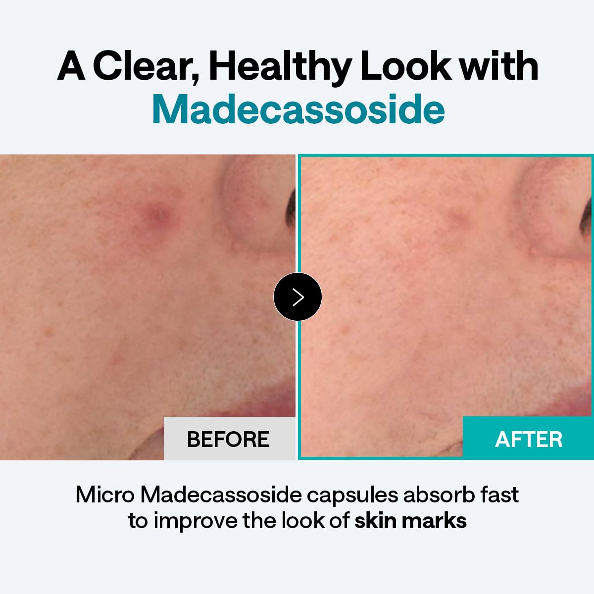 Mediheal Madecassoside Derma Cream 50mL | Wholesale K-Beauty