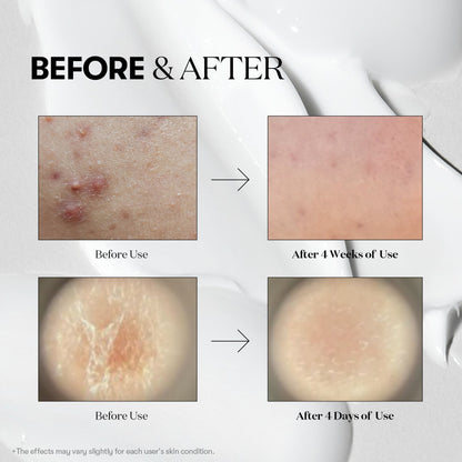 VT Cosmetics Reedle Shot 300 | Wholesale K-Beauty