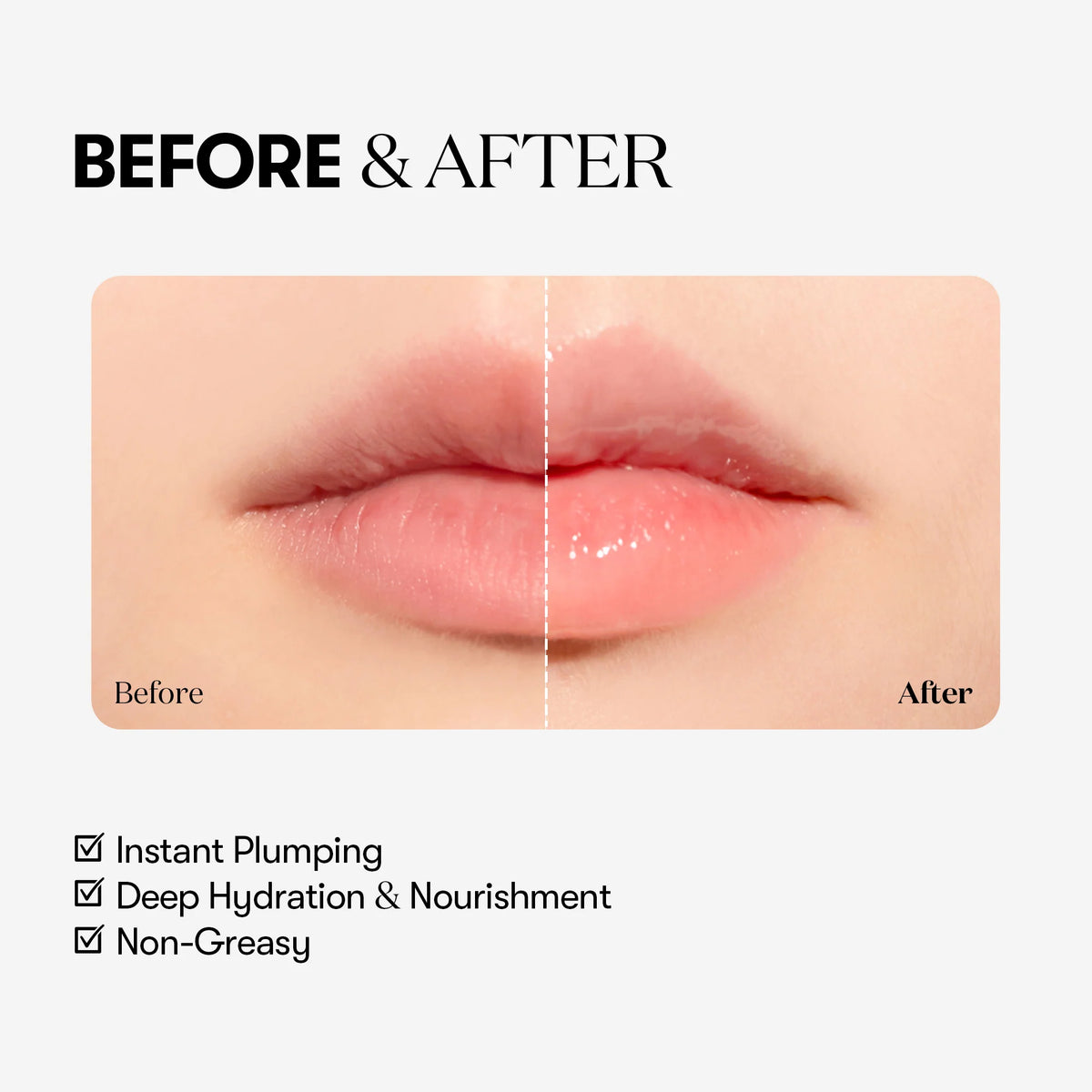 VT Cosmetics Reedle Shot Lip Plumper - Beginner | Wholesale K-Beauty