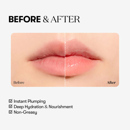 VT Cosmetics Reedle Shot Lip Plumper - Beginner | Wholesale K-Beauty