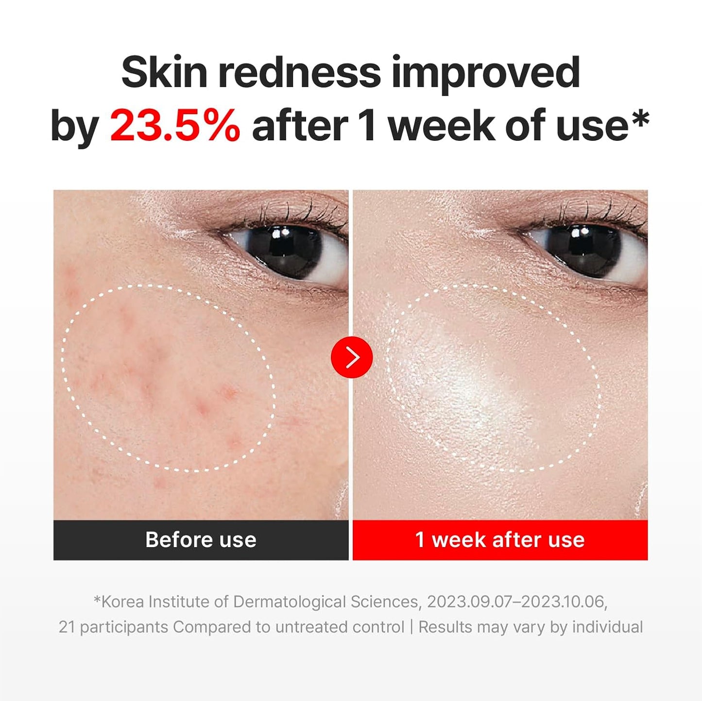 Centellian 24 Madeca Cream Time Reverse | Anti-Aging Korean Cream with TECA & Collagen | Wrinkle Care & Skin Firming | Wholesale K-Beauty