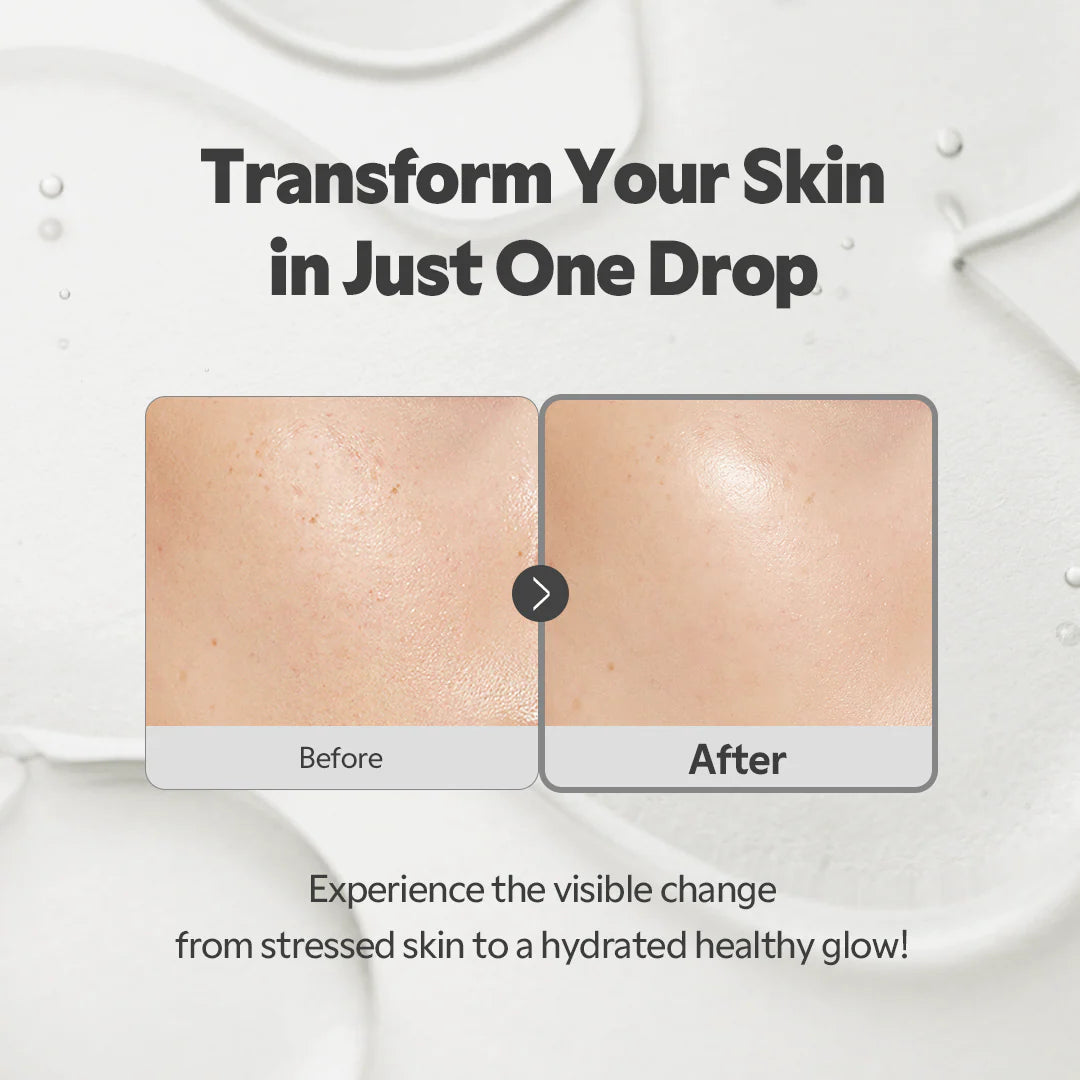 TIRTIR SOS Serum - Radiant Glow Boosting, Plumping, Anti Aging, Hydrating Face Serum | Wholesale K-Beauty