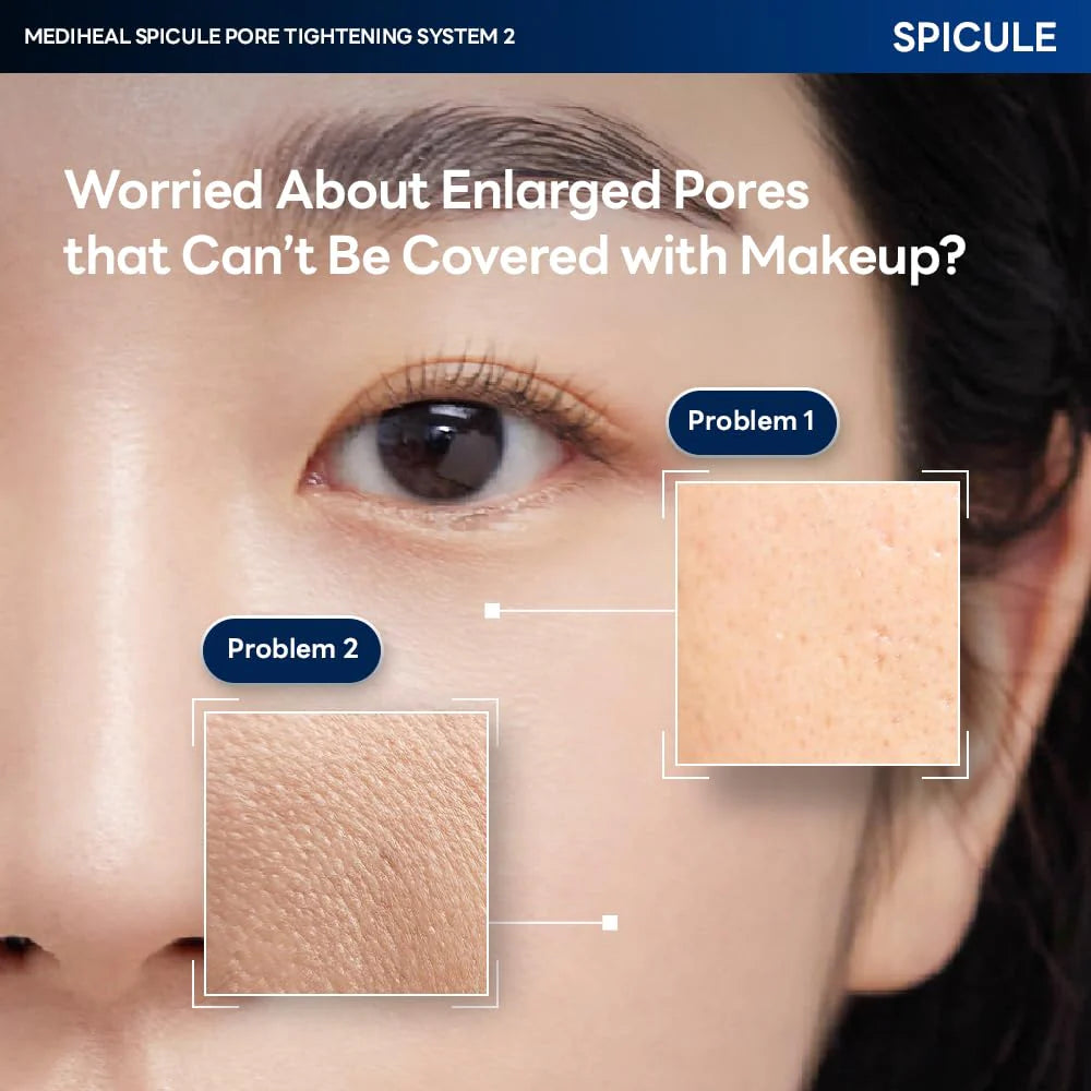 Close-up of enlarged pore concerns targeted by Mediheal Spicule System 2