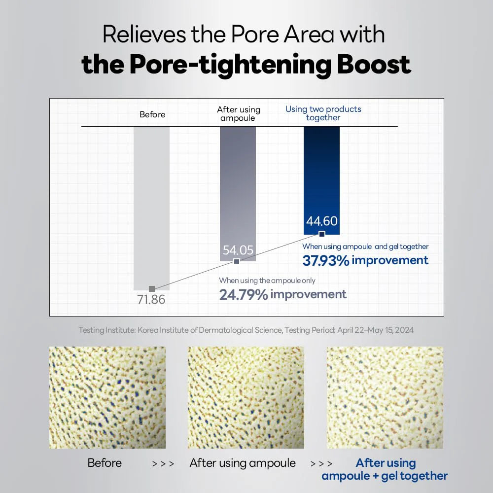 Clinical chart showing 37.93% improvement in pore tightening using full 2-step set